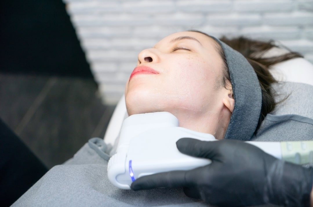 woman receiving hifu treatment