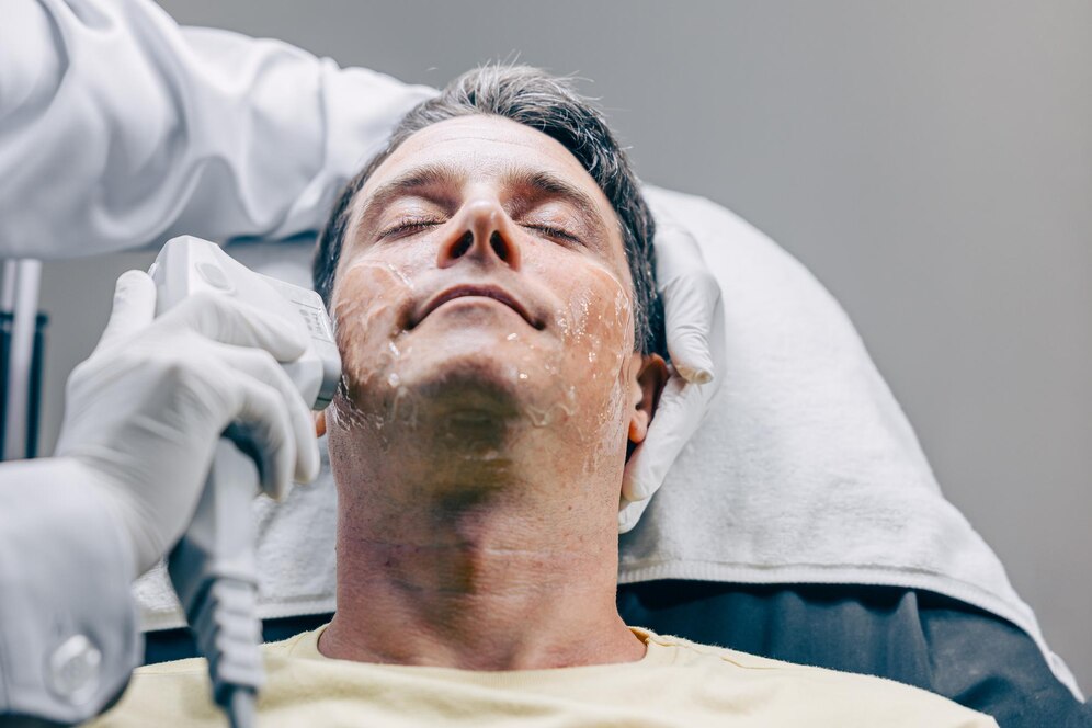 Thermage Treatment