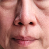 elognation of face