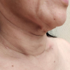 sagging jawline
