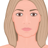 sagging of jowls