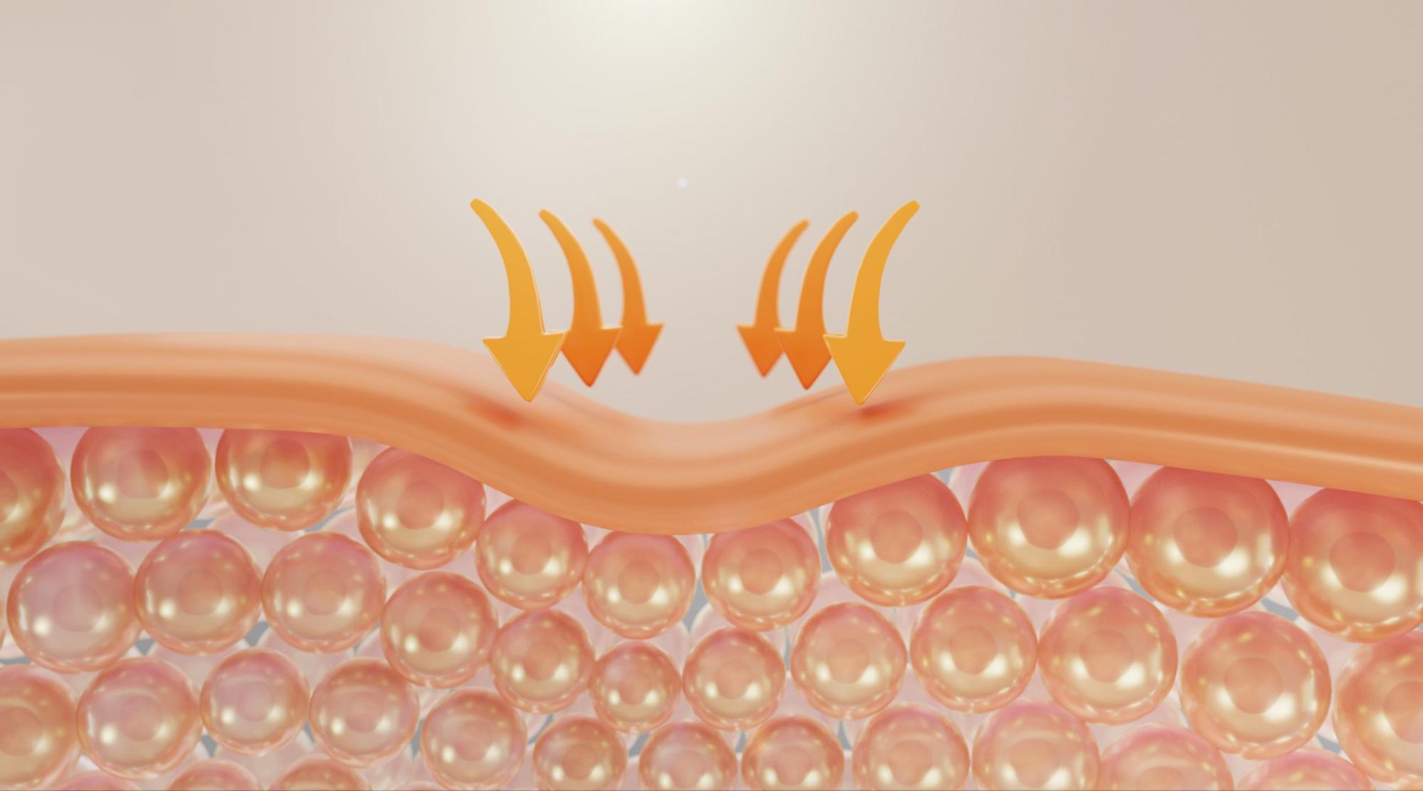 illustration of wrinkled skin