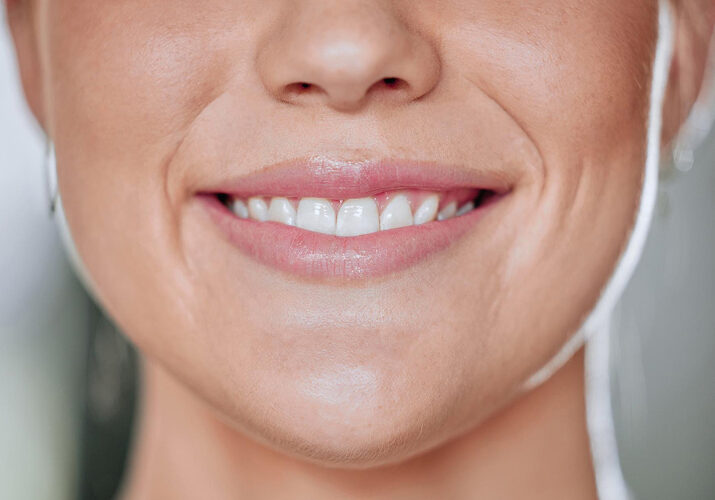 Close-up of a patient with hydrated skin and smile lines.