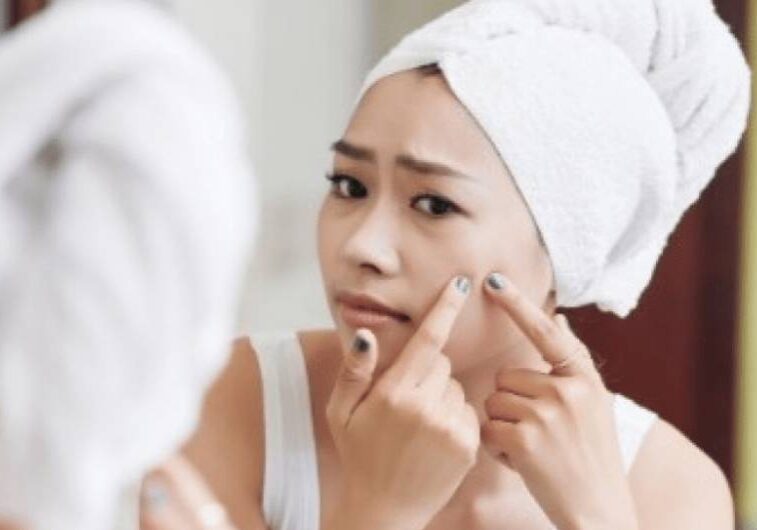 woman trying to pop pimple