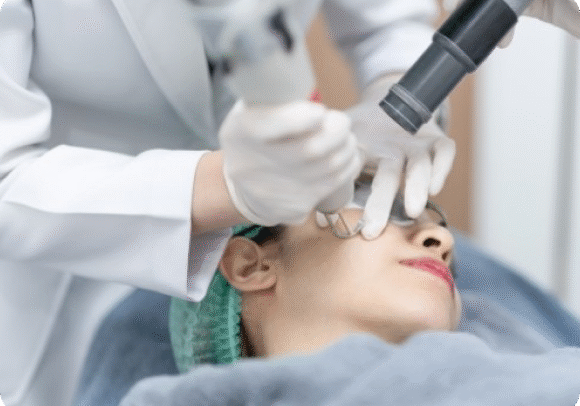 woman doing laser treatment