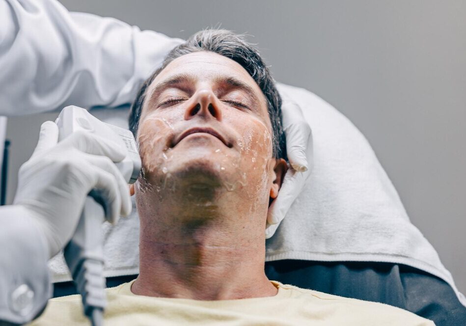 Thermage Treatment